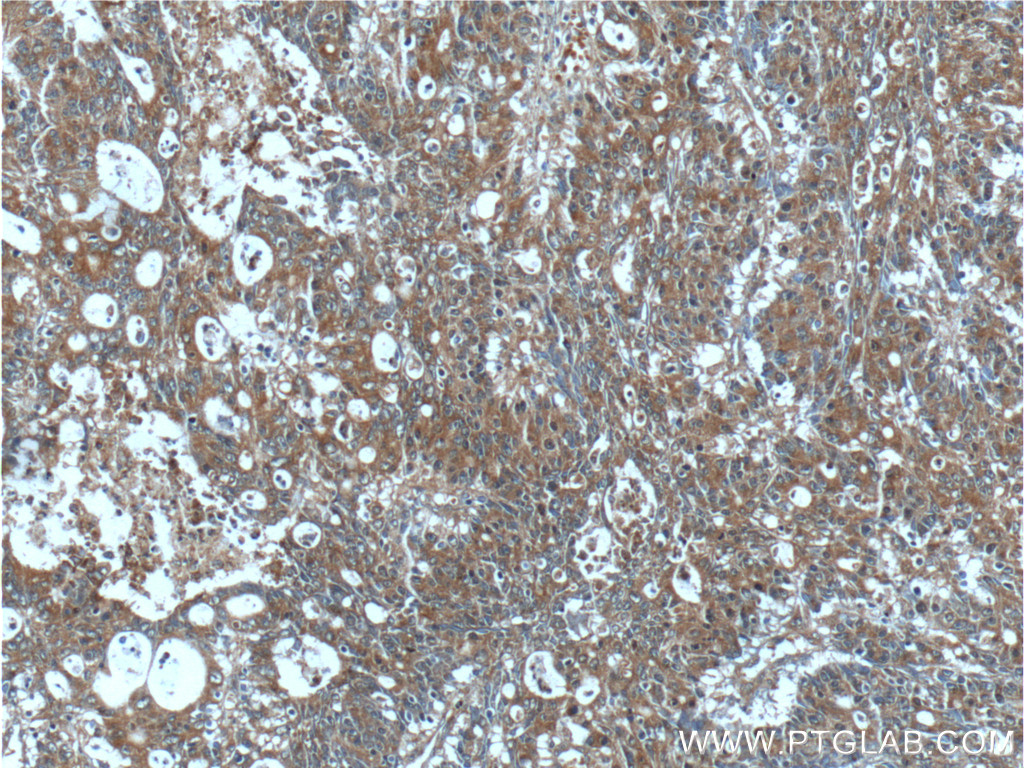 IL-36 Gamma Polyclonal antibody