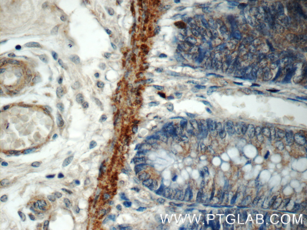 MRPL47 Polyclonal antibody