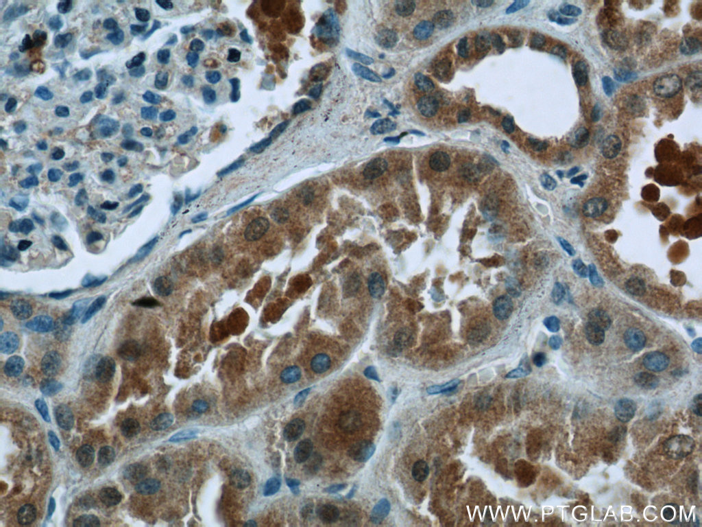 EFTUD1 Polyclonal antibody
