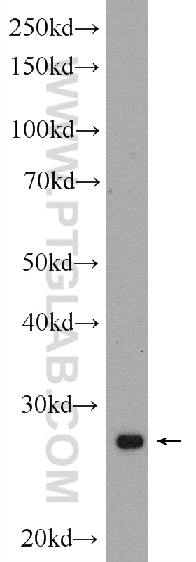 HELT Polyclonal antibody