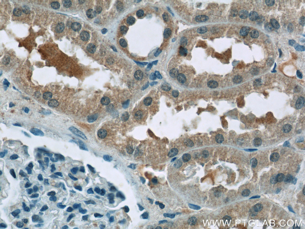 BTBD16 Polyclonal antibody