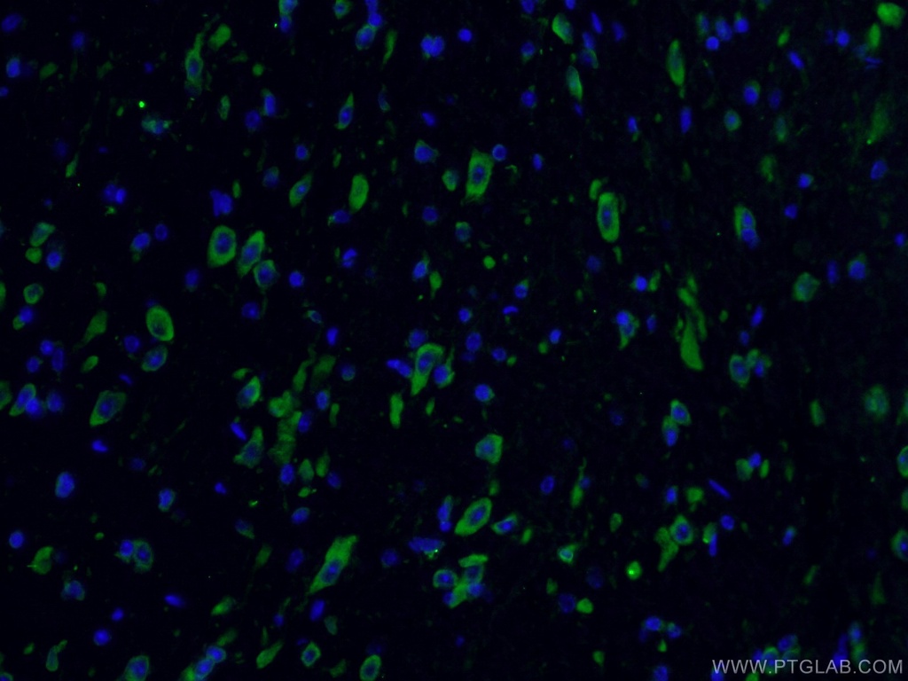 YTHDF2 Polyclonal antibody