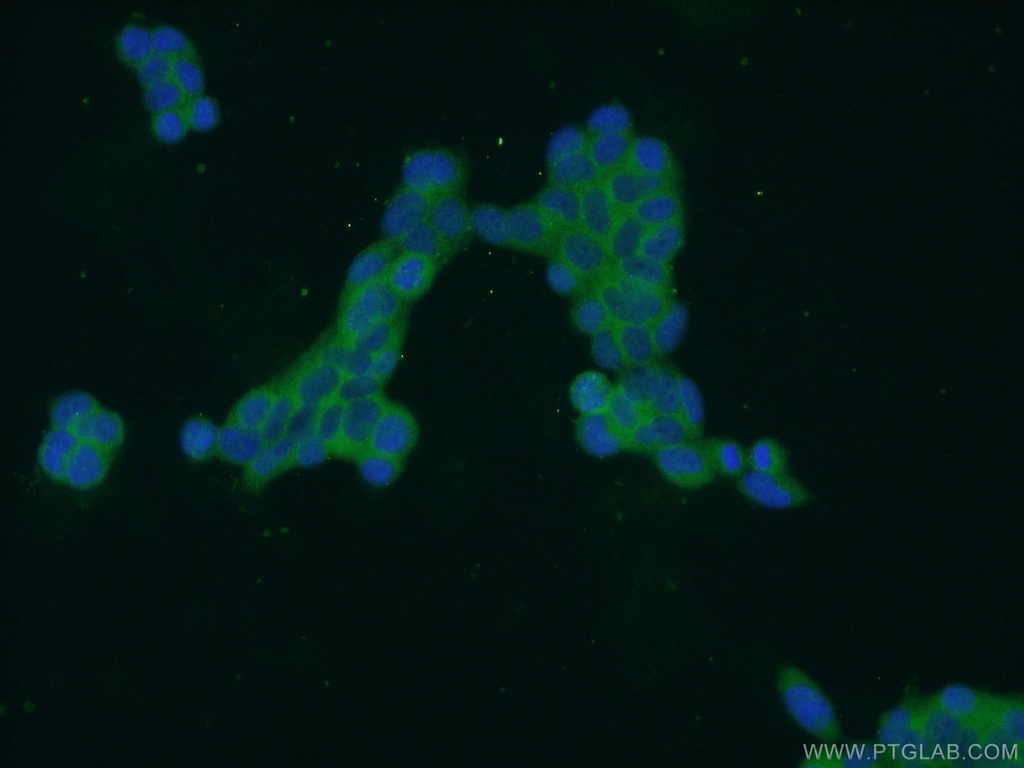 ZDHHC13 Polyclonal antibody