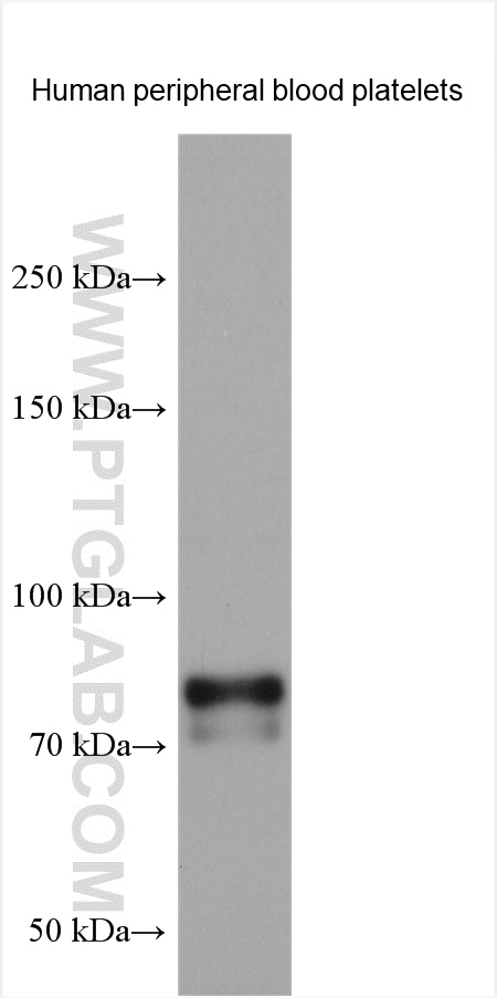TPOR/MPL  Polyclonal antibody