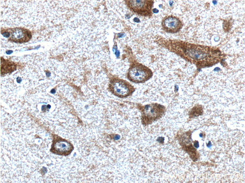PTGER3 Polyclonal antibody