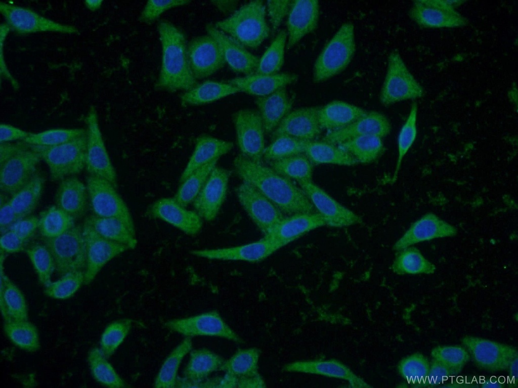 INSIG2 Polyclonal antibody