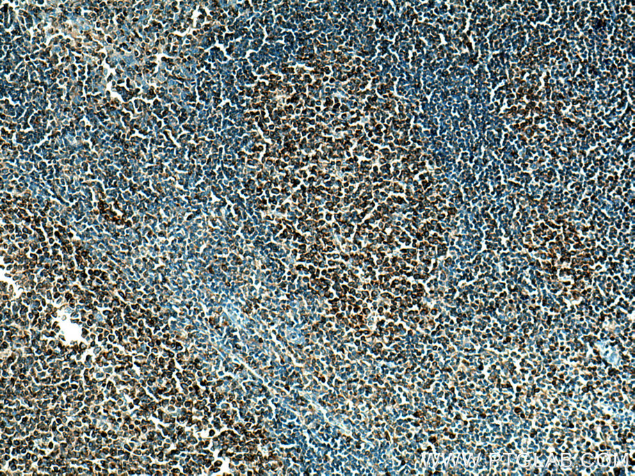 LRMP Polyclonal antibody