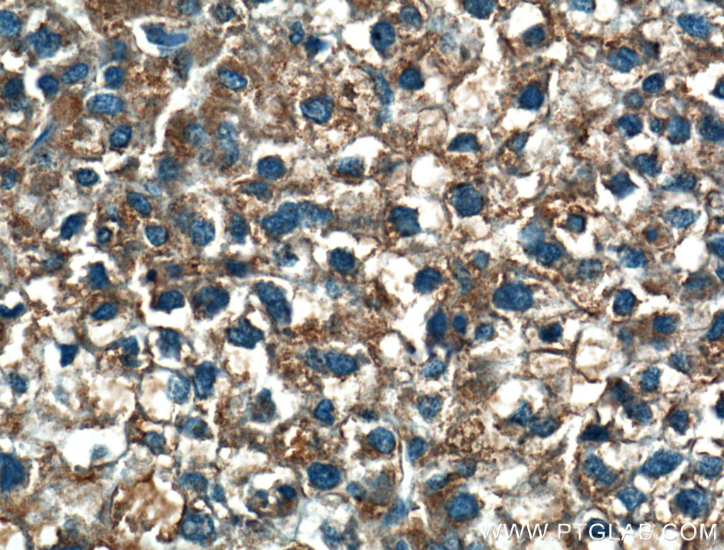 MOSC2 Polyclonal antibody