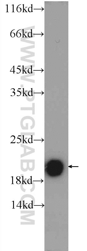 TMEM35 Polyclonal antibody