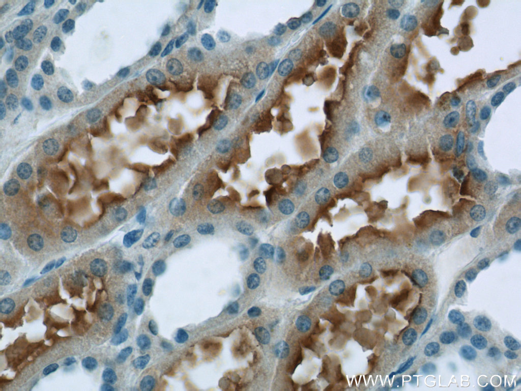 PHF14 Polyclonal antibody