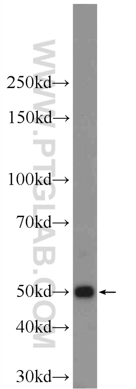 KRT12 Polyclonal antibody