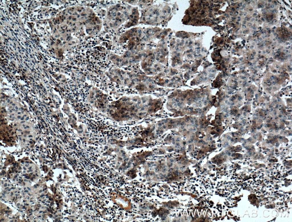 FAM174A Polyclonal antibody