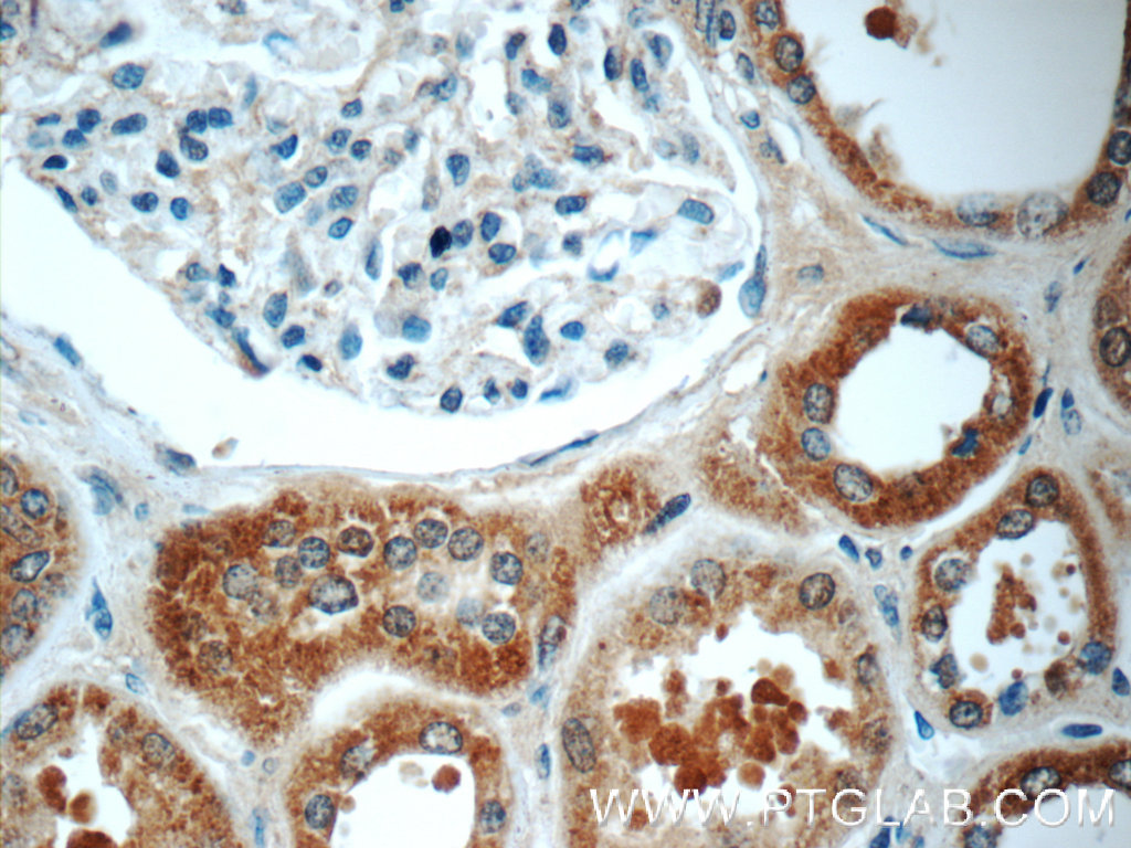 TMEM154 Polyclonal antibody