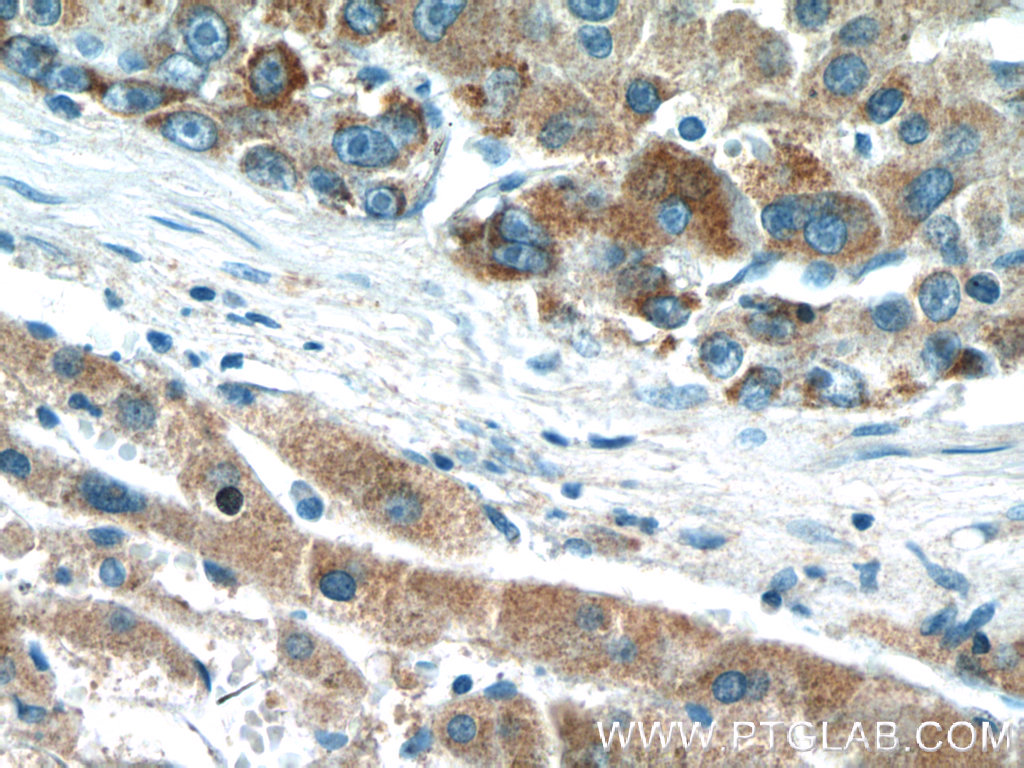 DMGDH Polyclonal antibody