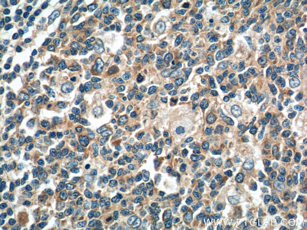 ATXN2L PolyClonal antibody