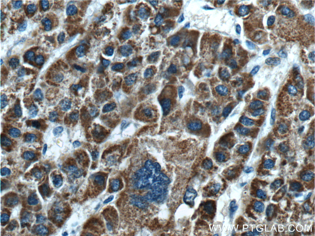 GLDC Polyclonal antibody