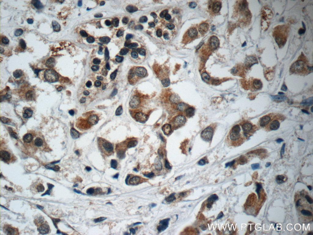 C13orf37 Polyclonal antibody