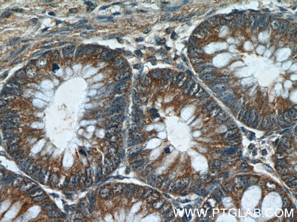 LRCH2 Polyclonal antibody