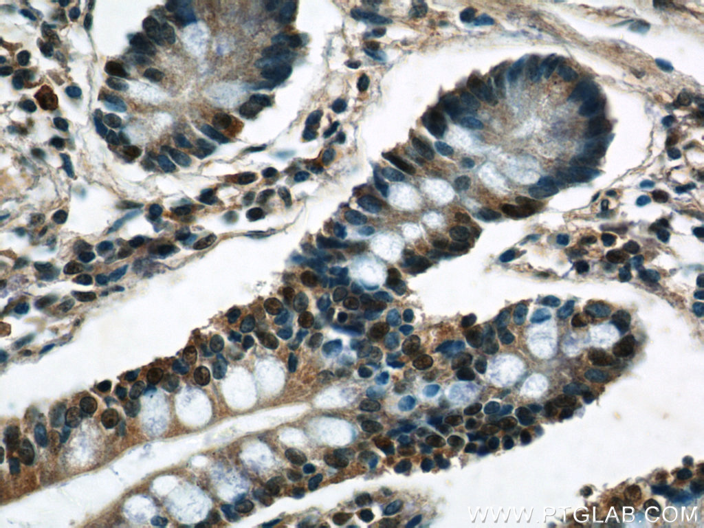 C22orf41 Polyclonal antibody