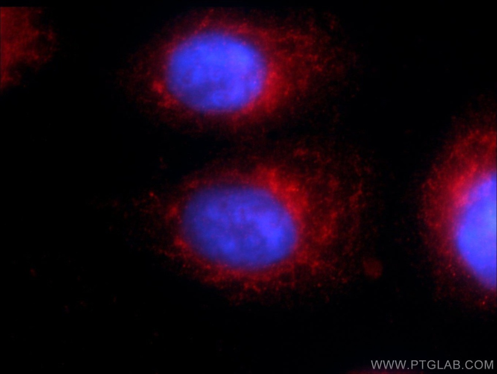 WDR81 Polyclonal antibody