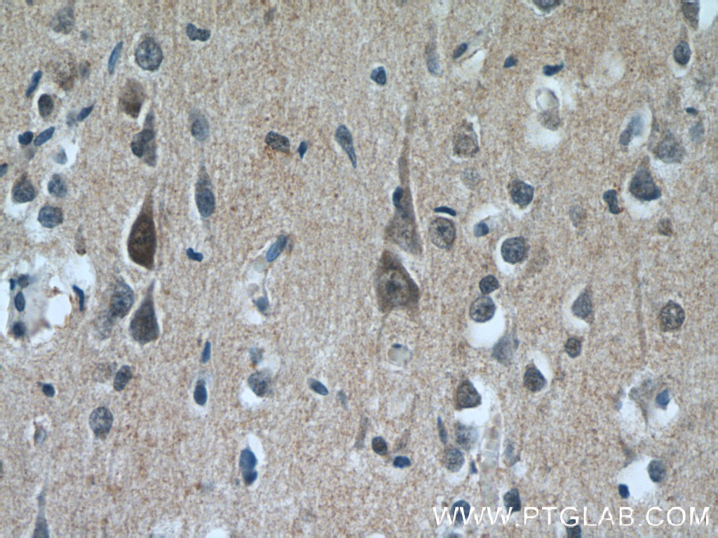 PPP2R3C Polyclonal antibody
