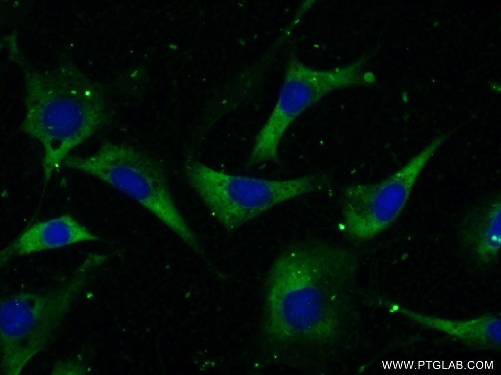 CCT2 Polyclonal antibody