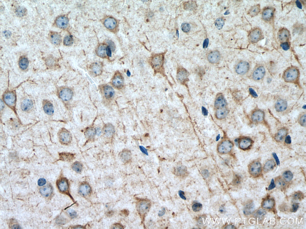 TMEM161A Polyclonal antibody