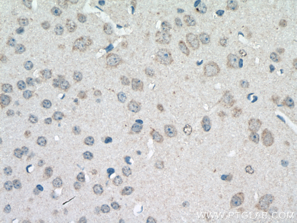 SLC22A23 Polyclonal antibody