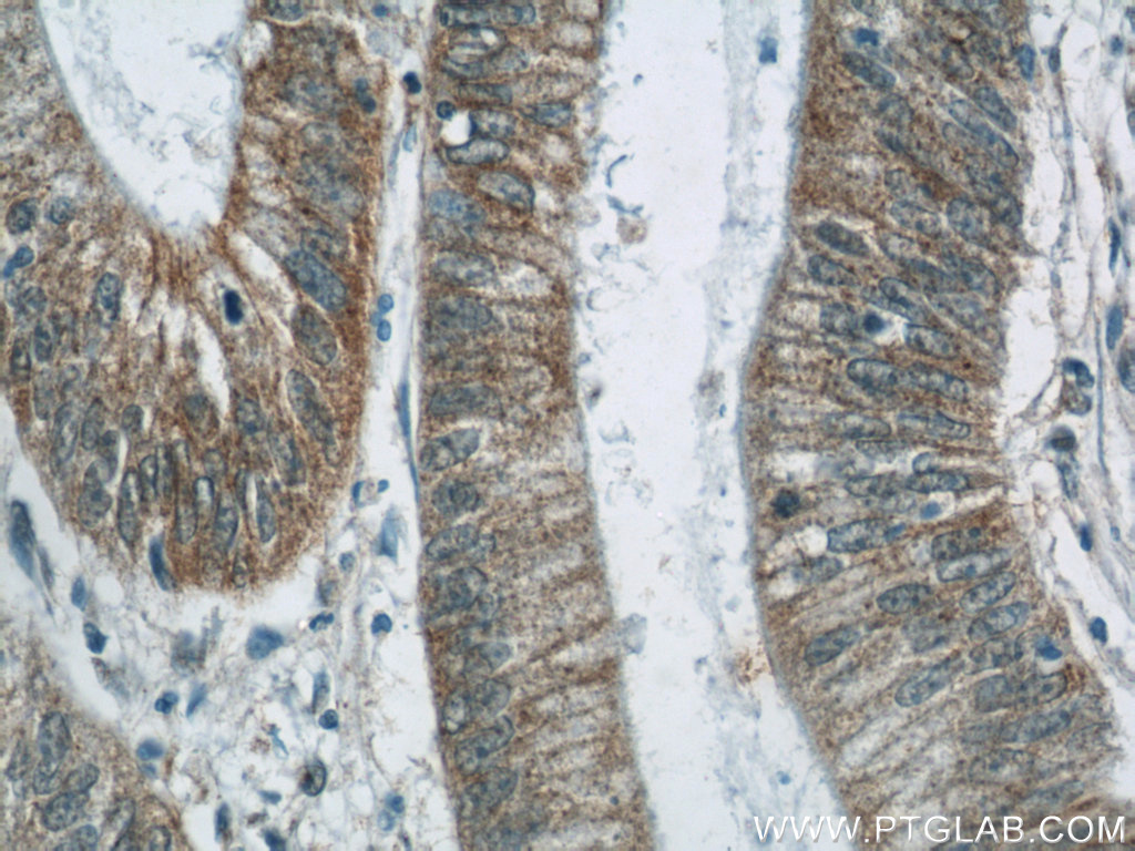 TMEM190 Polyclonal antibody