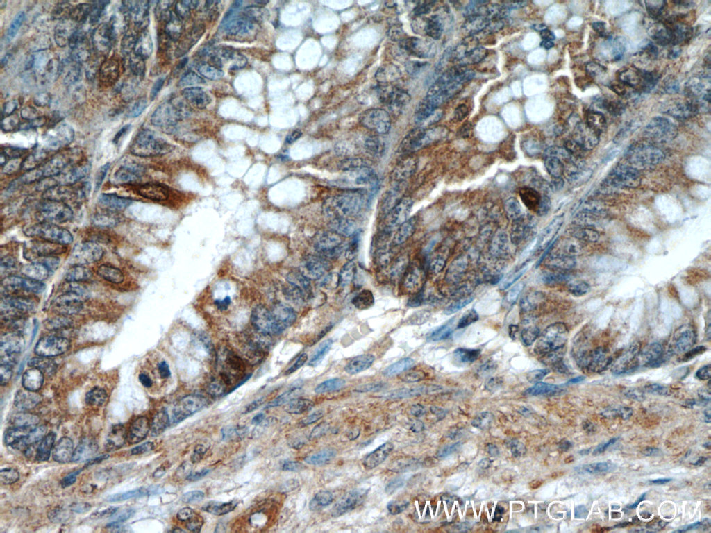 Prokineticin 2 Polyclonal antibody