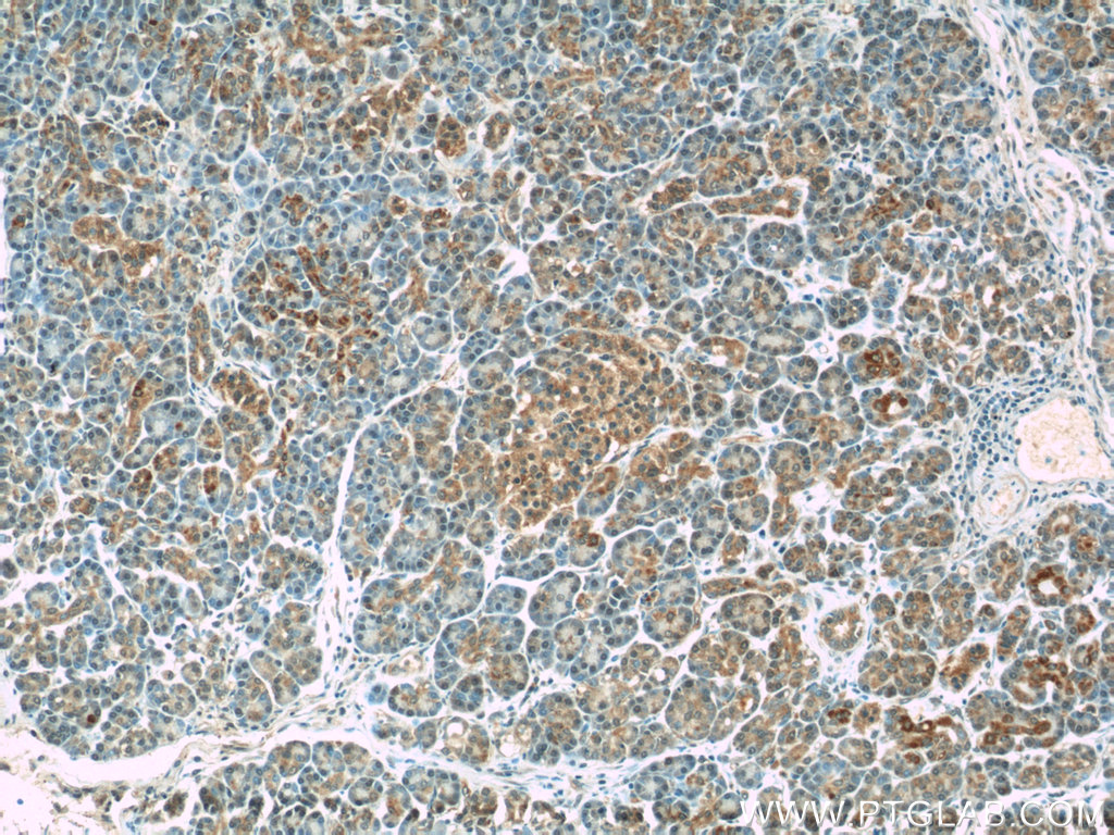 WFDC3 Polyclonal antibody
