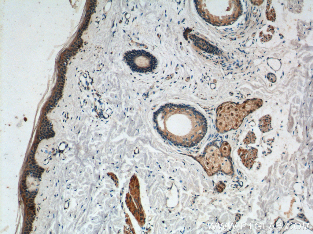 ST8SIA1 Polyclonal antibody