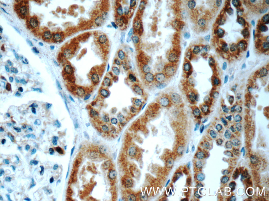 TMEM213 Polyclonal antibody