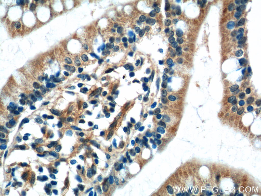 C2orf47 Polyclonal antibody