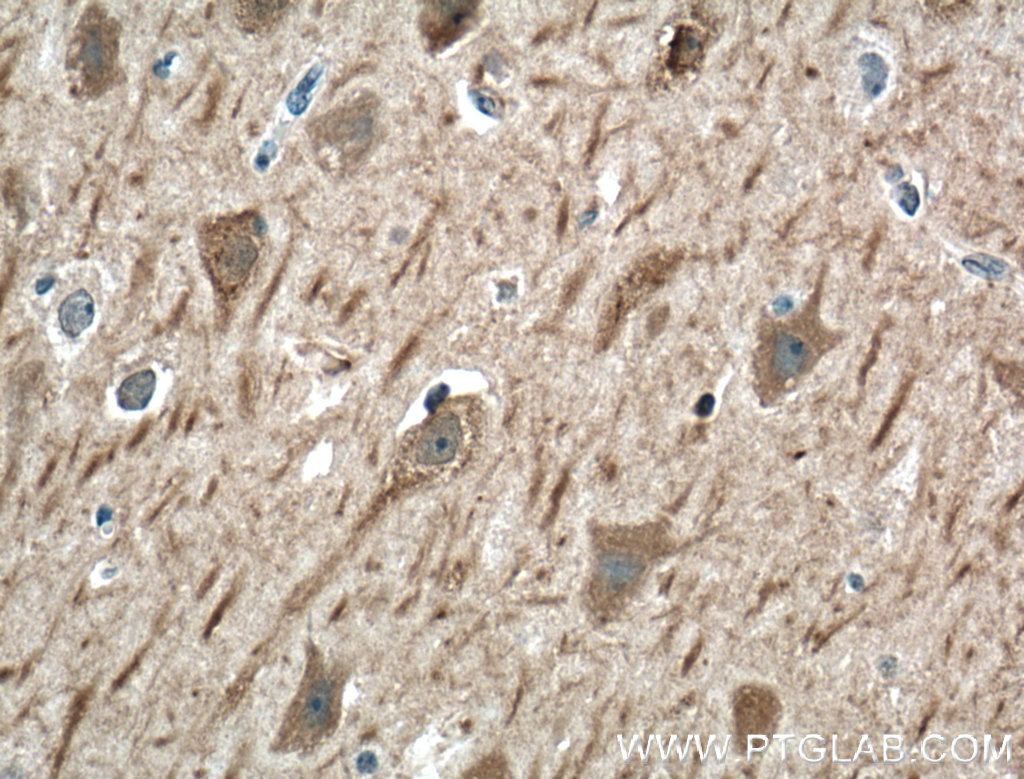 SRBD1 Polyclonal antibody