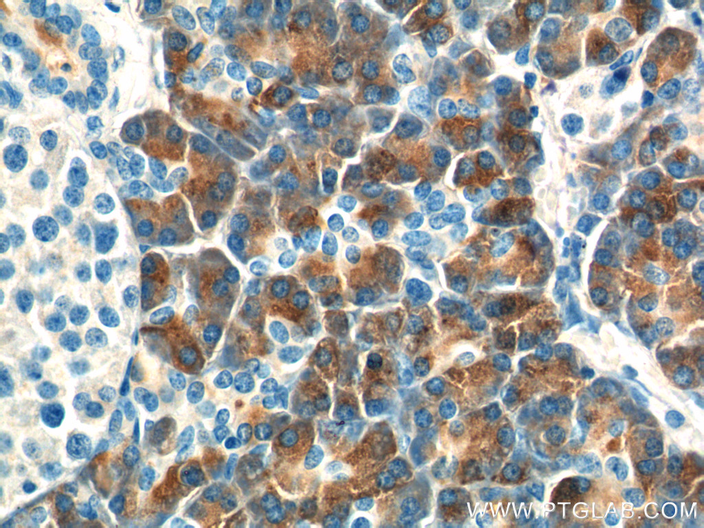 CTRB1 Polyclonal antibody