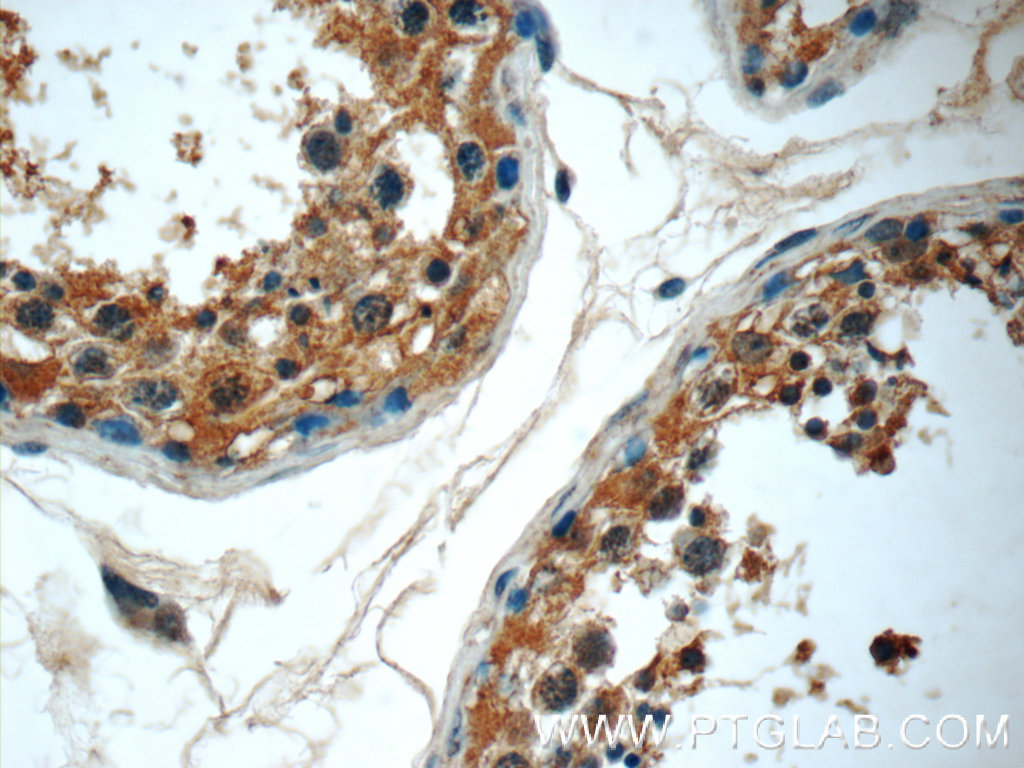 RPL39L Polyclonal antibody