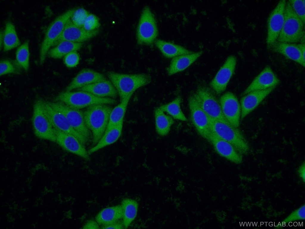 SCCPDH Polyclonal antibody