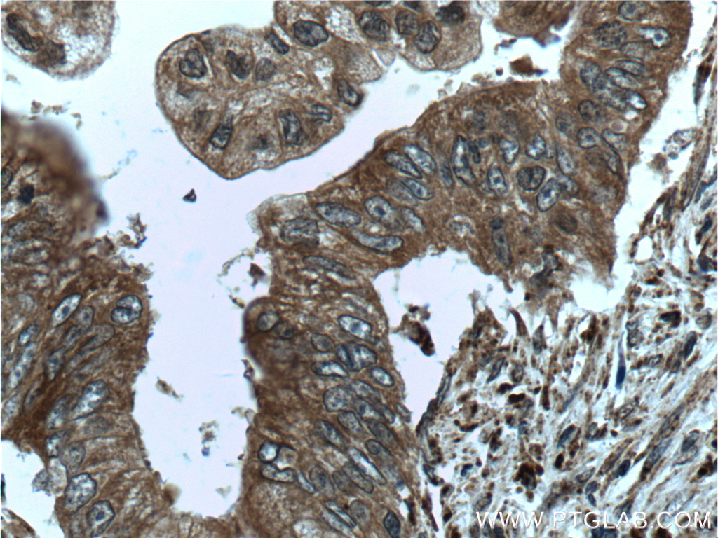 ME2 Polyclonal antibody