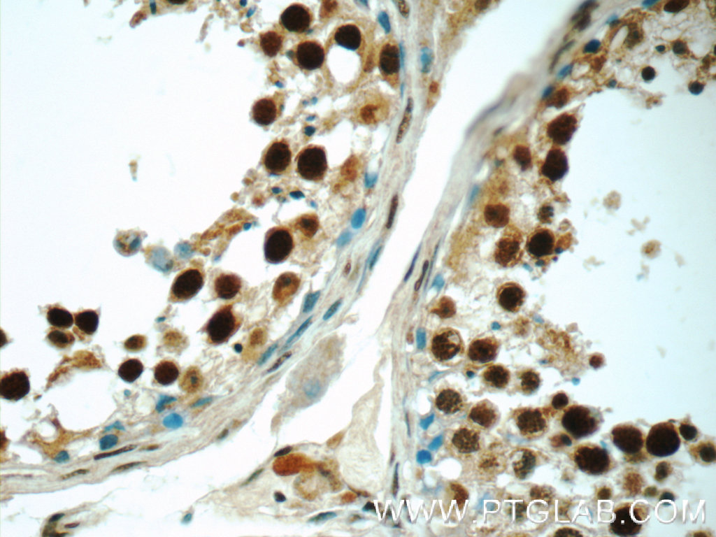HIC1 Polyclonal antibody