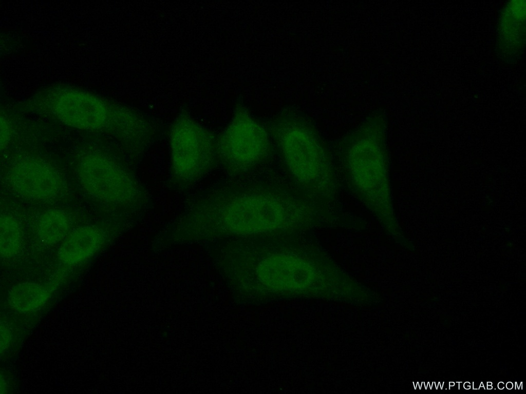 ZNF30 Polyclonal antibody