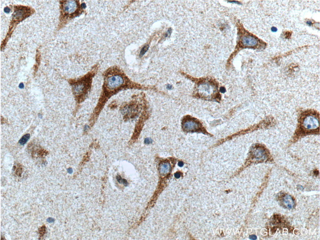 GPR111 Polyclonal antibody