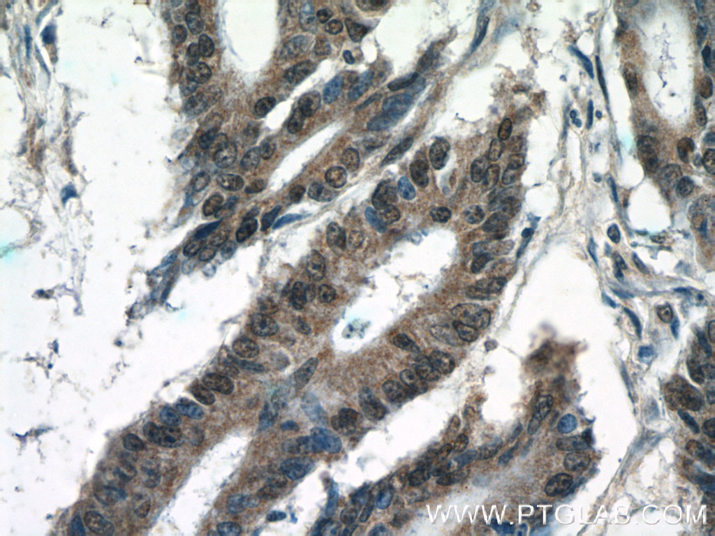 KIAA0087 Polyclonal antibody