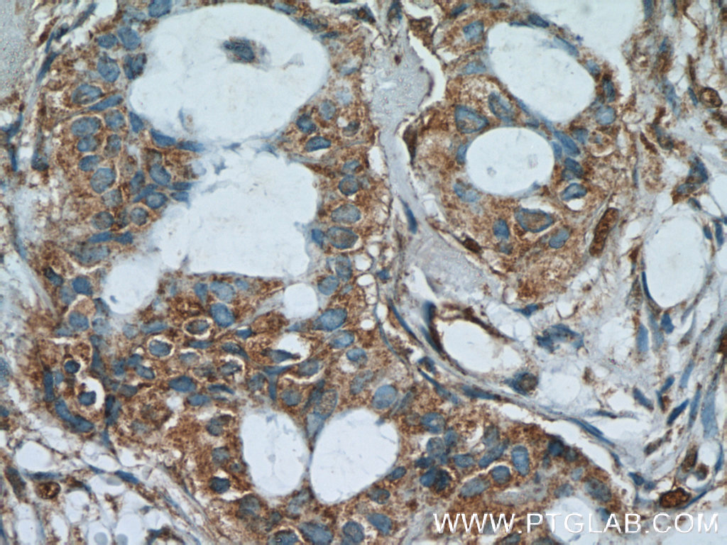 AKAP4 Polyclonal antibody