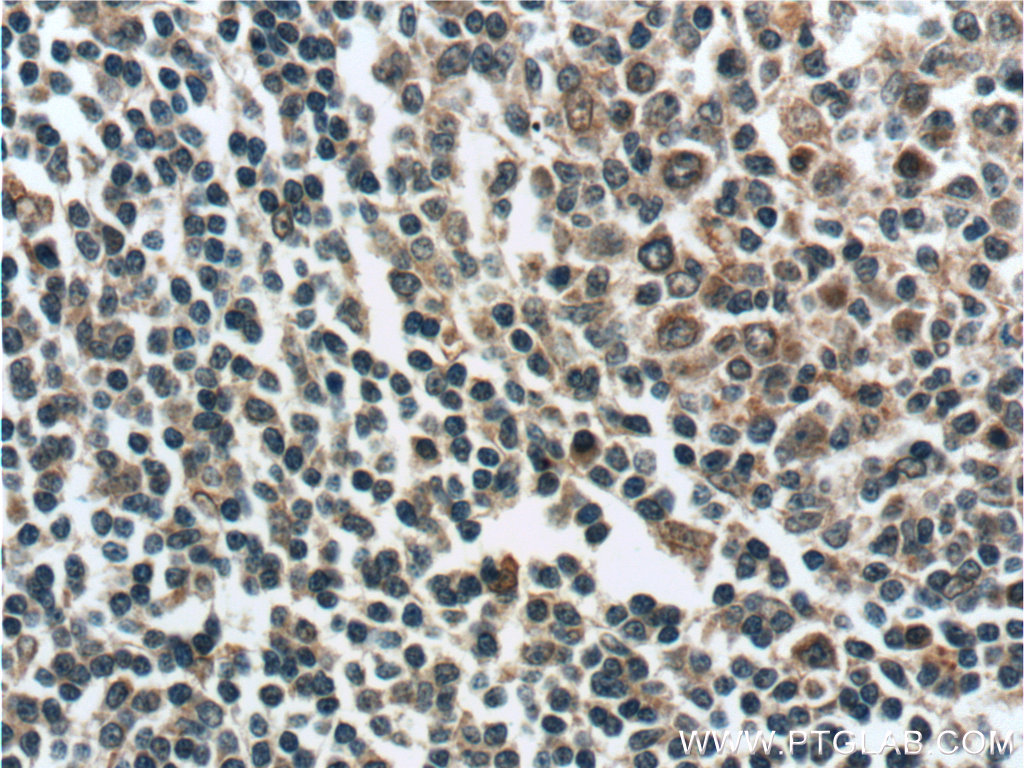 ZC3H12D Polyclonal antibody
