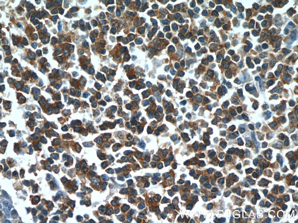 HCLS1 Polyclonal antibody