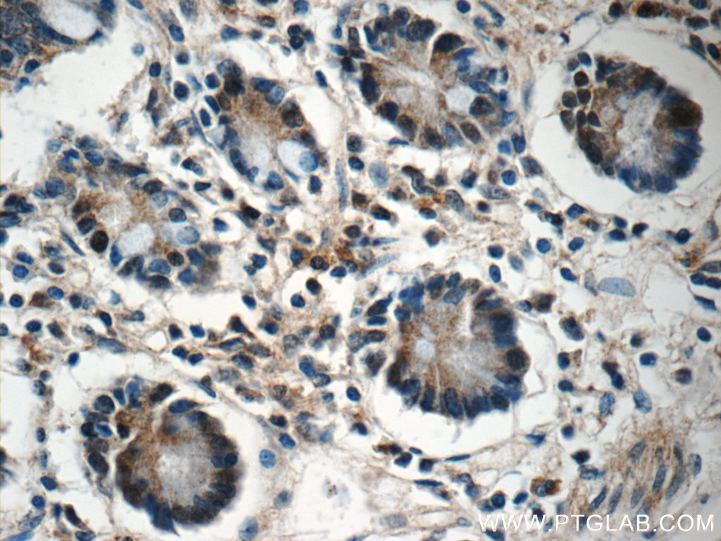 ZC3H12A Polyclonal antibody