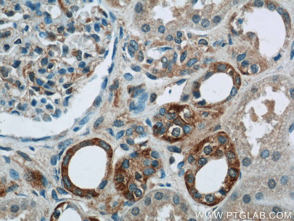 PIPPIN Polyclonal antibody