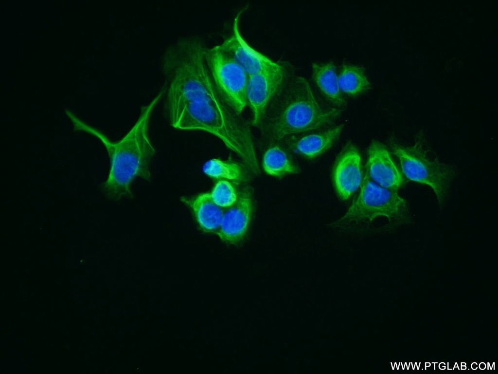 LRCH1 Polyclonal antibody