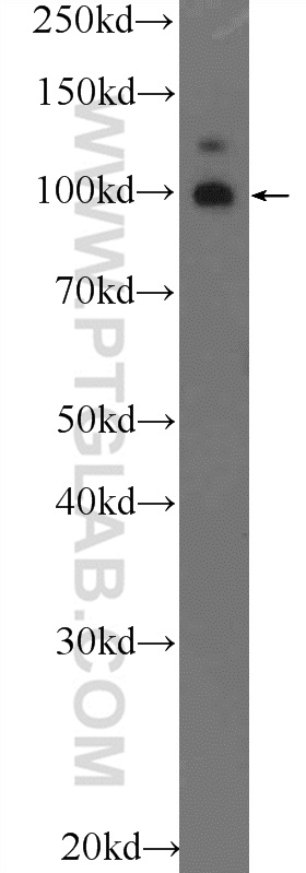 TSHZ3 Polyclonal antibody